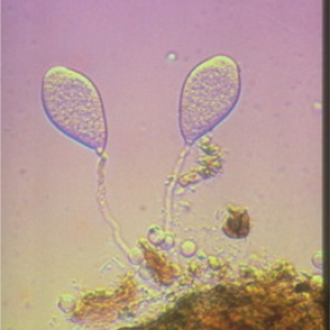 Plasmopara